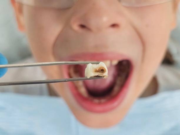 Best Tooth Infection Emergency Dentist  in Girard, OH